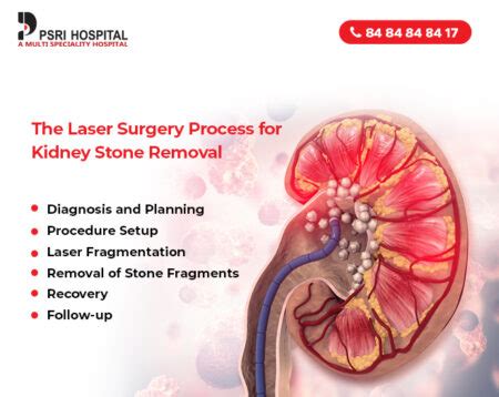 Comprehensive Guide to Organ Transplantation: Life-Saving Treatments, Recovery Processes, and Key Considerations for Successful Transplants