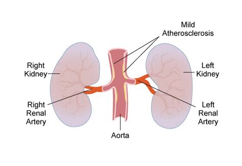 Comprehensive Guide to Revascularization: Effective Treatments, Procedures, and Benefits for Restoring Blood Flow