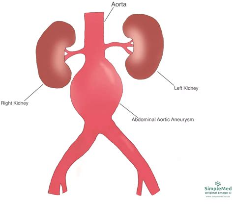 Comprehensive Guide to Revascularization: Effective Treatments, Procedures, and Benefits for Restoring Blood Flow